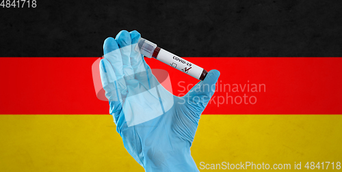 Image of hand holding beaker with coronavirus blood test