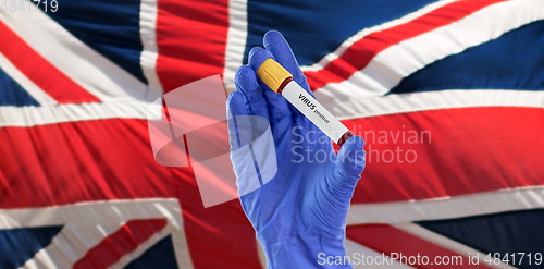 Image of hand holding beaker with positive virus blood test