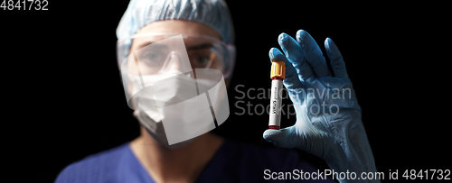 Image of doctor holding beaker with virus blood test