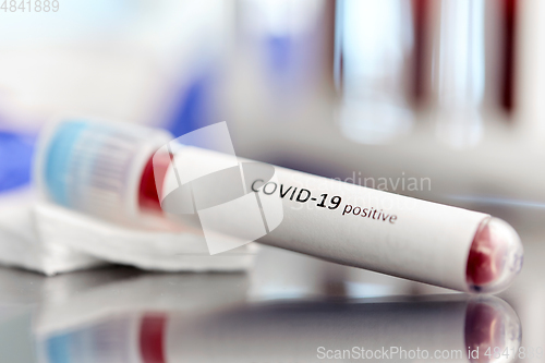 Image of beaker with coronavirus blood test at laboratory