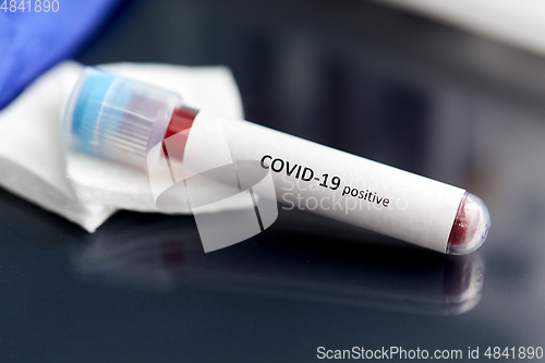 Image of beaker with coronavirus blood test at laboratory