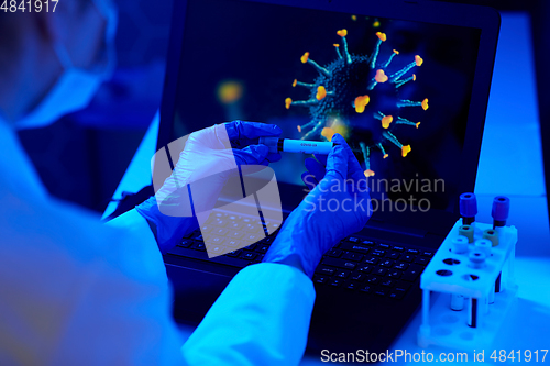 Image of hand holding beaker with coronavirus blood test