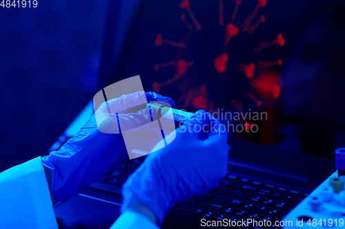 Image of hand holding beaker with coronavirus blood test