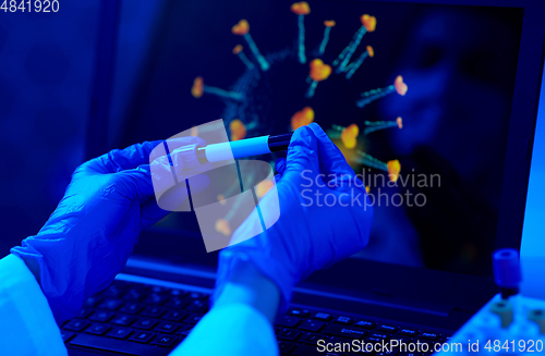 Image of hand holding beaker with coronavirus blood test