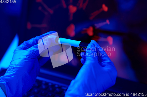 Image of hand holding beaker with coronavirus blood test