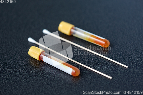 Image of test tubes with blood plasma and cotton swabs