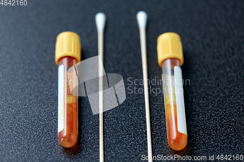 Image of test tubes with blood plasma and cotton swabs