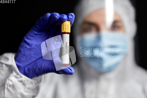 Image of scientist holding beaker with virus blood test