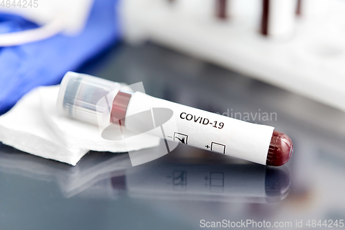 Image of beaker with coronavirus blood test at laboratory