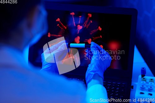 Image of hand holding beaker with coronavirus blood test