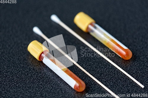 Image of test tubes with blood plasma and cotton swabs