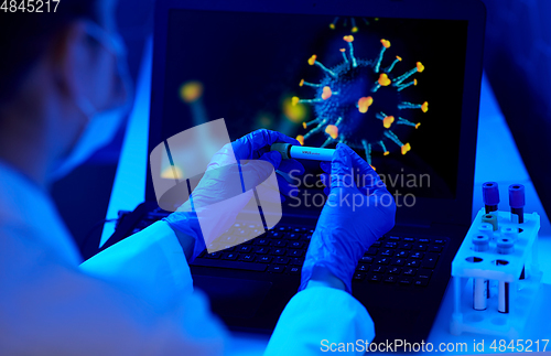 Image of hand holding beaker with coronavirus blood test