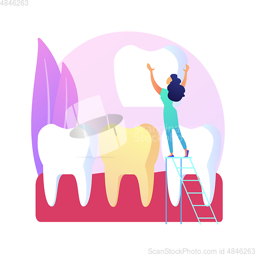 Image of Dental veneers abstract concept vector illustration.