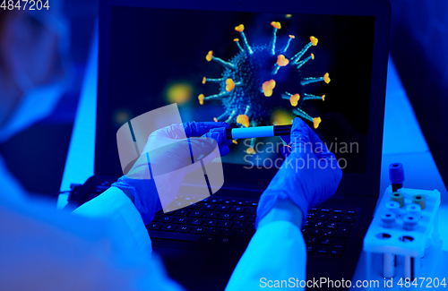 Image of hand holding beaker with coronavirus blood test