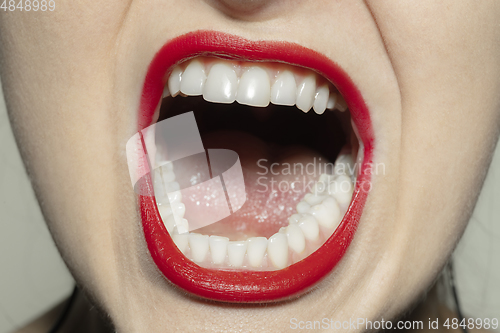 Image of Close-up female mouth with bright red gloss lips make-up. Cosmetology, dentistry and beauty care, emotions