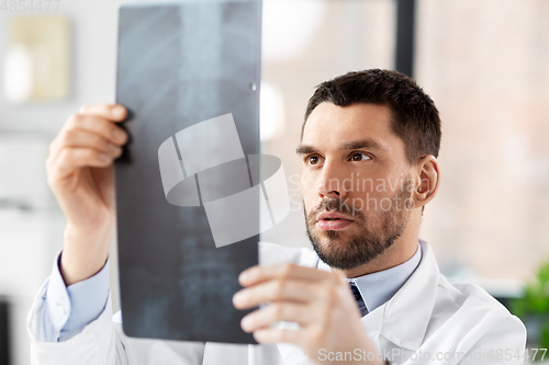 Image of male doctor with x-ray of spine at hospital