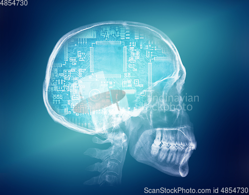 Image of Human skull X-ray image. Artificial intelligence concept