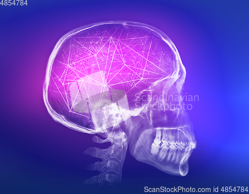 Image of Human skull X-ray image. Artificial intelligence concept