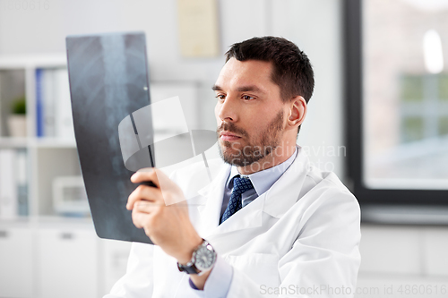 Image of male doctor with x-ray of spine at hospital