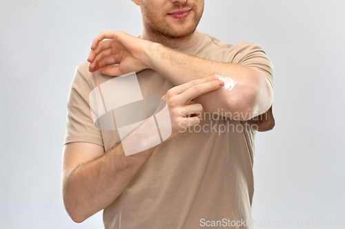 Image of young man applying pain medication to his elbow