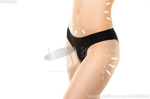 Image of Cellulite removal plan. The black markings on young woman body preparing for plastic surgery. Concept of body correction