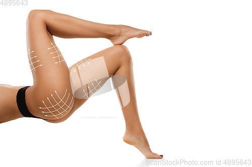 Image of Cellulite removal plan. The black markings on young woman body preparing for plastic surgery. Concept of body correction