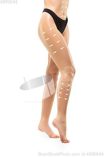 Image of Cellulite removal plan. The black markings on young woman body preparing for plastic surgery. Concept of body correction