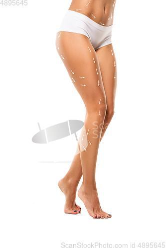 Image of Cellulite removal plan. The black markings on young woman body preparing for plastic surgery. Concept of body correction