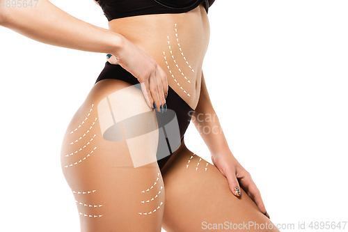 Image of Cellulite removal plan. The black markings on young woman body preparing for plastic surgery. Concept of body correction