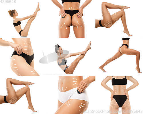 Image of Cellulite removal plan. The black markings on young women body preparing for plastic surgery. Concept of body correction