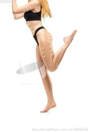 Image of Cellulite removal plan. The black markings on young woman body preparing for plastic surgery. Concept of body correction