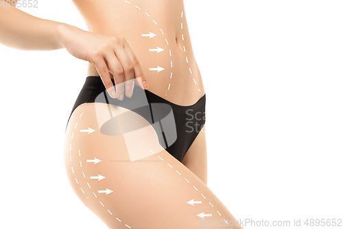 Image of Cellulite removal plan. The black markings on young woman body preparing for plastic surgery. Concept of body correction