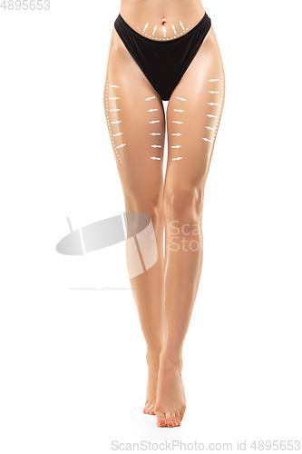 Image of Cellulite removal plan. The black markings on young woman body preparing for plastic surgery. Concept of body correction