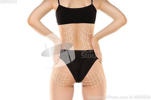 Image of Cellulite removal plan. The black markings on young woman body preparing for plastic surgery. Concept of body correction