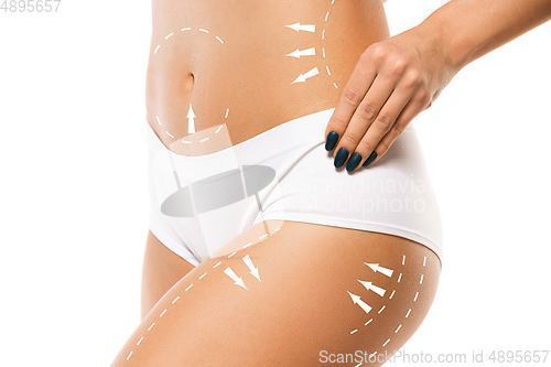 Image of Cellulite removal plan. The black markings on young woman body preparing for plastic surgery. Concept of body correction