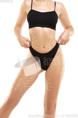 Image of Cellulite removal plan. The black markings on young woman body preparing for plastic surgery. Concept of body correction