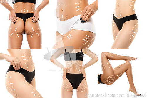 Image of Cellulite removal plan. The black markings on young woman body preparing for plastic surgery. Concept of body correction