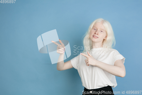 Image of Portrait of beautiful caucasian albino girl isolated on blue studio background