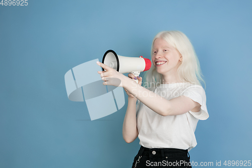 Image of Portrait of beautiful caucasian albino girl isolated on blue studio background