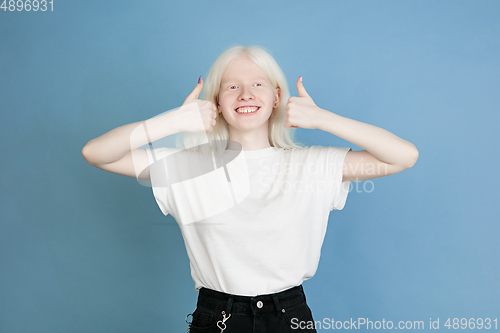 Image of Portrait of beautiful caucasian albino girl isolated on blue studio background