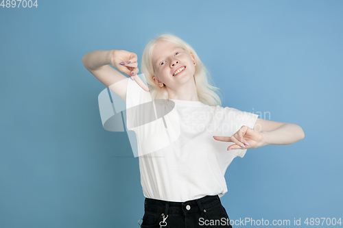 Image of Portrait of beautiful caucasian albino girl isolated on blue studio background