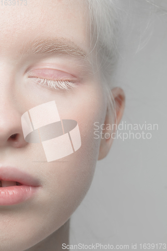 Image of Close up portrait of beautiful albino woman isolated on studio background. Beauty, fashion, skincare, cosmetics concept. Details.