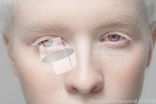 Image of Close up portrait of beautiful albino woman isolated on studio background. Beauty, fashion, skincare, cosmetics concept. Details.