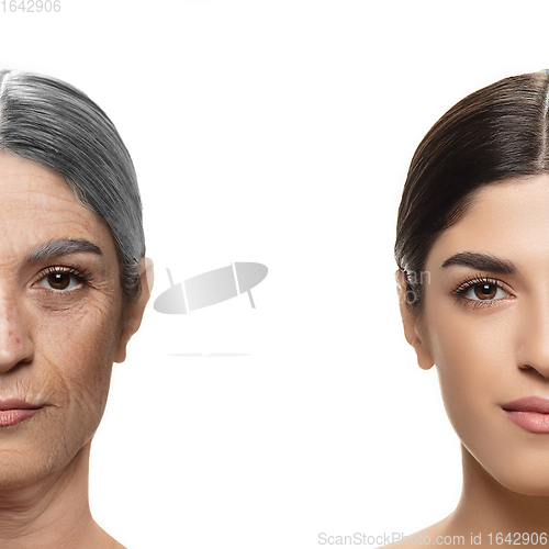 Image of Comparison. Portrait of beautiful woman with problem and clean skin, aging and youth concept, beauty treatment and lifting.