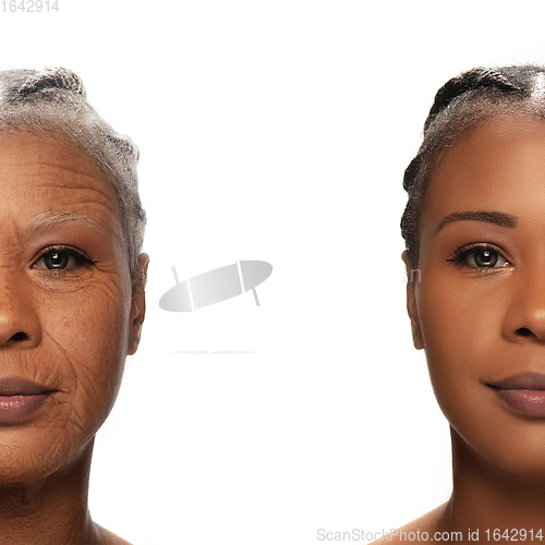 Image of Comparison. Portrait of beautiful woman with problem and clean skin, aging and youth concept, beauty treatment and lifting.