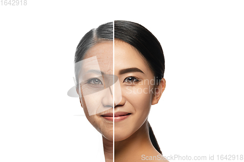 Image of Comparison. Portrait of beautiful woman with problem and clean skin, aging and youth concept, beauty treatment and lifting.