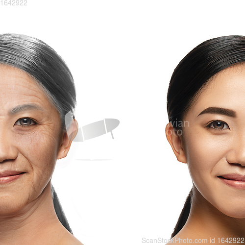 Image of Comparison. Portrait of beautiful woman with problem and clean skin, aging and youth concept, beauty treatment and lifting.