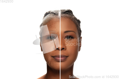 Image of Comparison. Portrait of beautiful woman with problem and clean skin, aging and youth concept, beauty treatment and lifting.