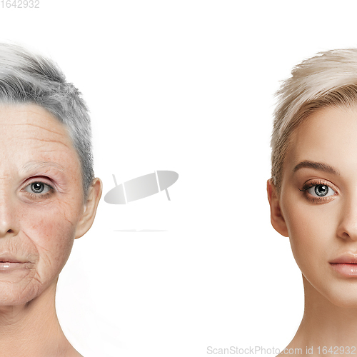 Image of Comparison. Portrait of beautiful woman with problem and clean skin, aging and youth concept, beauty treatment and lifting.