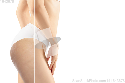 Image of Overweight woman with fat cellulite legs and buttocks, obesity female body in white underwear comparing with fit and thin body isolated on white background